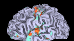 Ricostruita nel cervello l'origine della paura immotivata