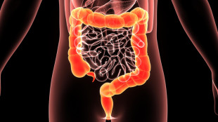 Tumori, bloccare proteina può aumentare l'effetto della chemio